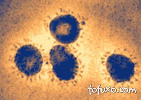 Coronavirose – Saiba mais sobre esta doença