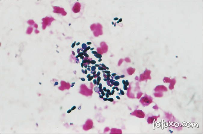 Malassezia pachydermatis 